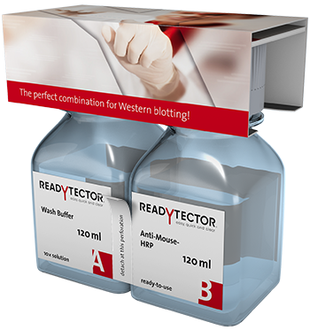 Immunodetection procedure with ReadyTector® - Western Blotting: easy, quick und clear.
